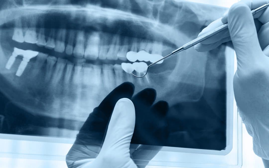 dr wood examining teeth during dental exam