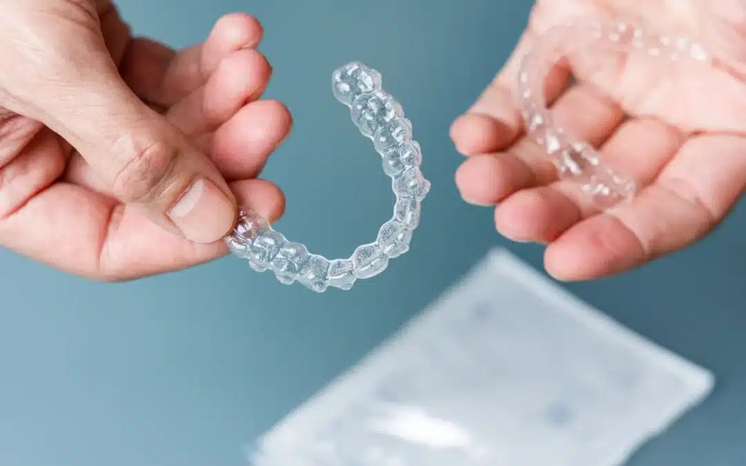 Can Clear Aligners Fix an Open Bite?